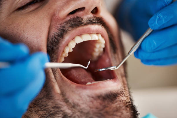 Best Broken or Chipped Tooth Repair in Milton, WI